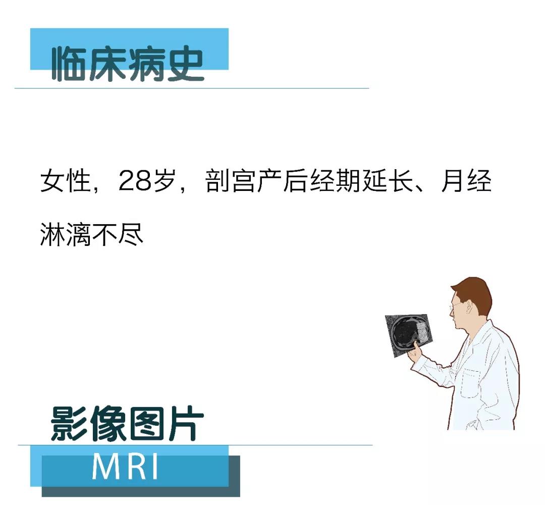 【朗润影像档案】磁共振影像病例分享（编号20180309）