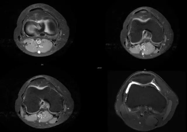 1550543552666575.jpg 1550543552666575.jpg