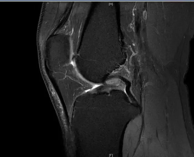 1550556378681178.jpg 1550556378681178.jpg