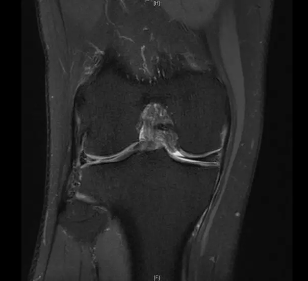 1550556446389404.jpg 1550556446389404.jpg