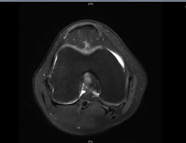 1550556462288275.jpg 1550556462288275.jpg