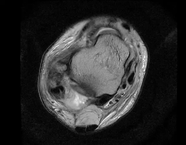 1550557267222350.jpg 1550557267222350.jpg