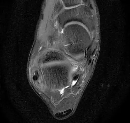 1550557818463736.jpg 1550557818463736.jpg