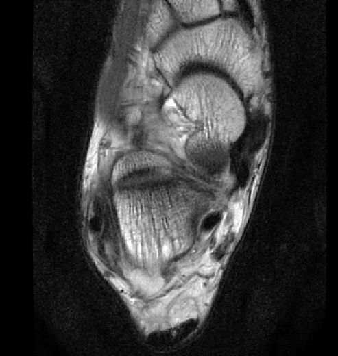 1550557919315314.jpg 1550557919315314.jpg