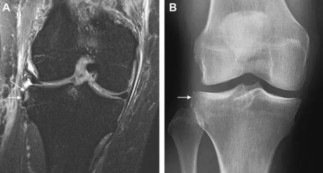 1550564214696291.jpg 640.webp (28).jpg