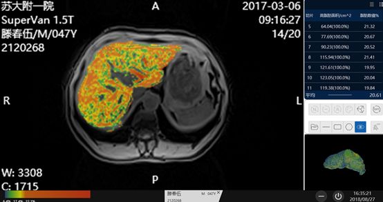 1563181097318758.jpg 18.jpg