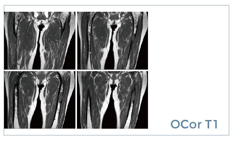 【朗润影像档案】磁共振影像病例分享(编号20190712)