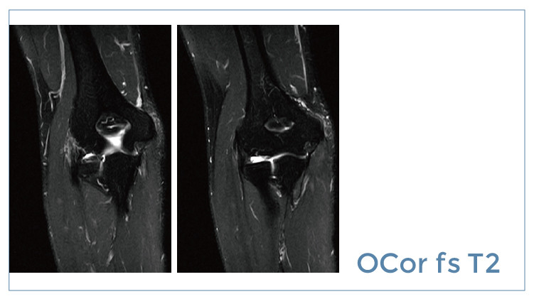 【朗润影像档案】磁共振影像病例分享(编号20190726)