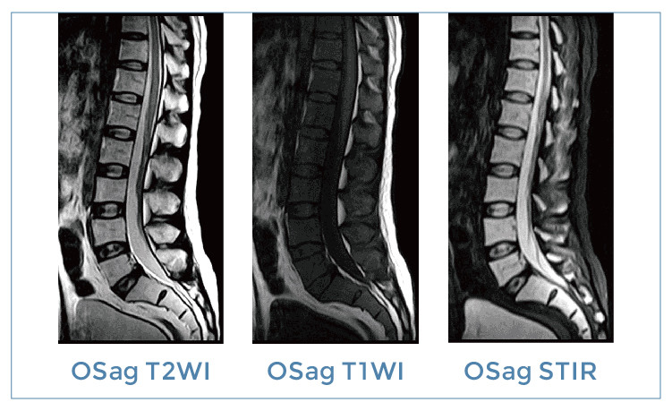 【朗润影像档案】磁共振影像病例分享(编号20190906)