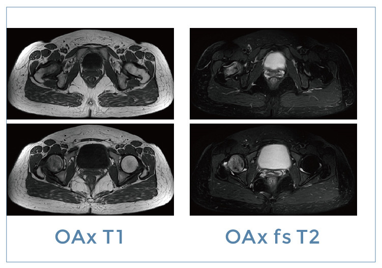 【朗润影像档案】磁共振影像病例分享(编号20191206)